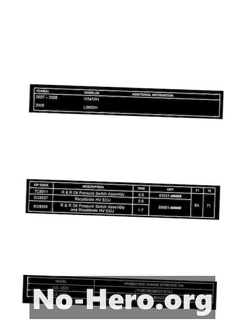 P0867 - Getriebeöldrucksensor (TFP)